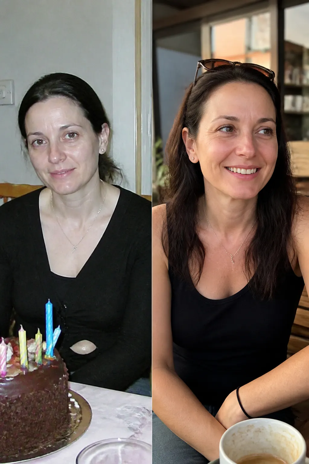 Before and after - Amara, 29