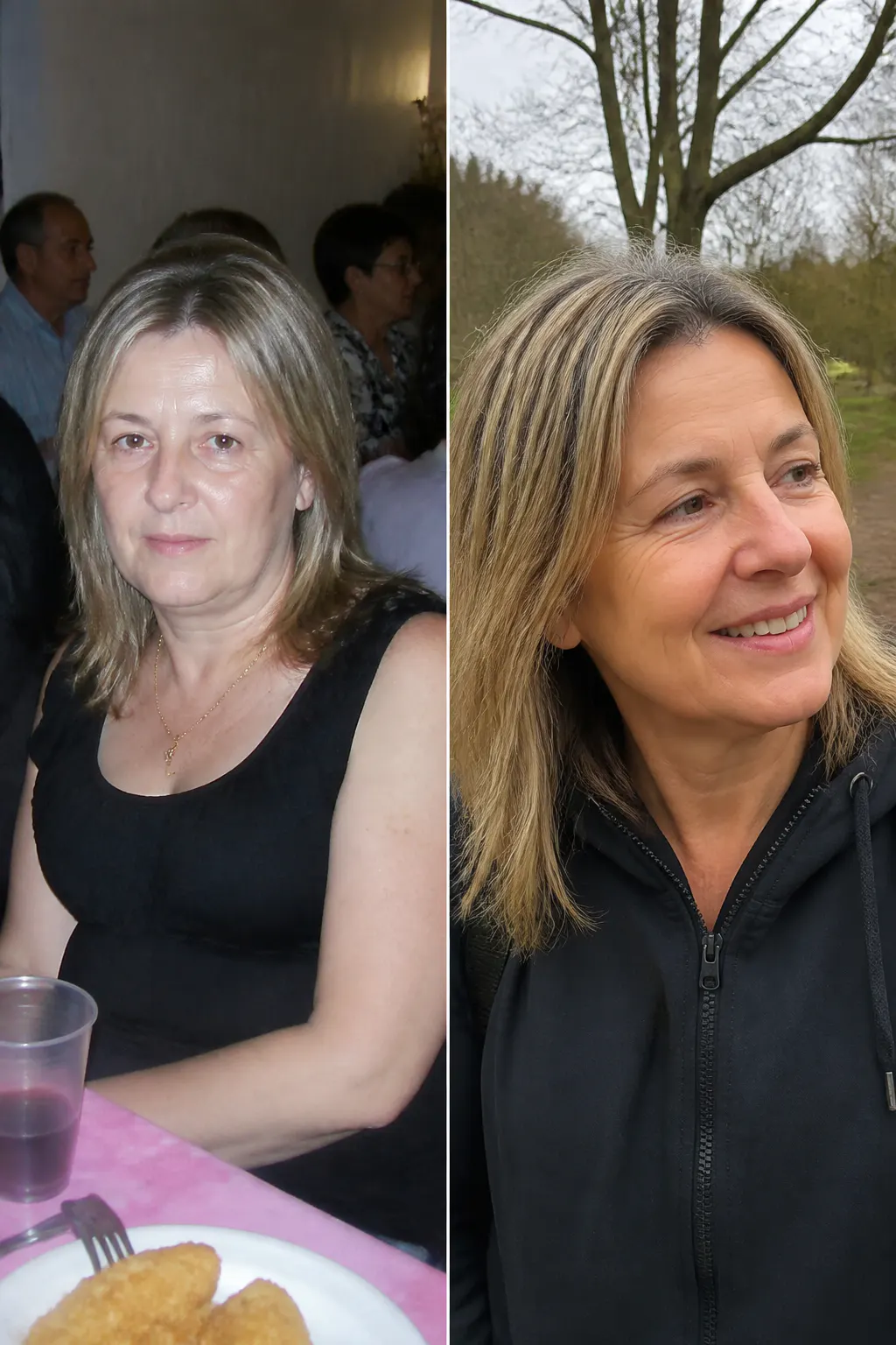 Before and after - Naomi, 37