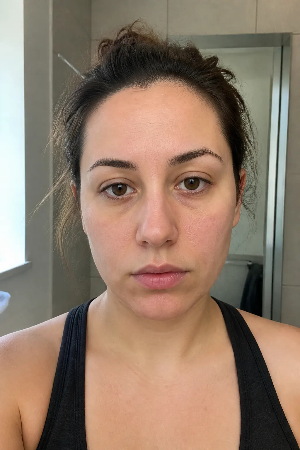 Before - Mia R.
