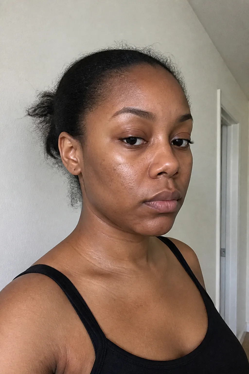 Before - Priya N.