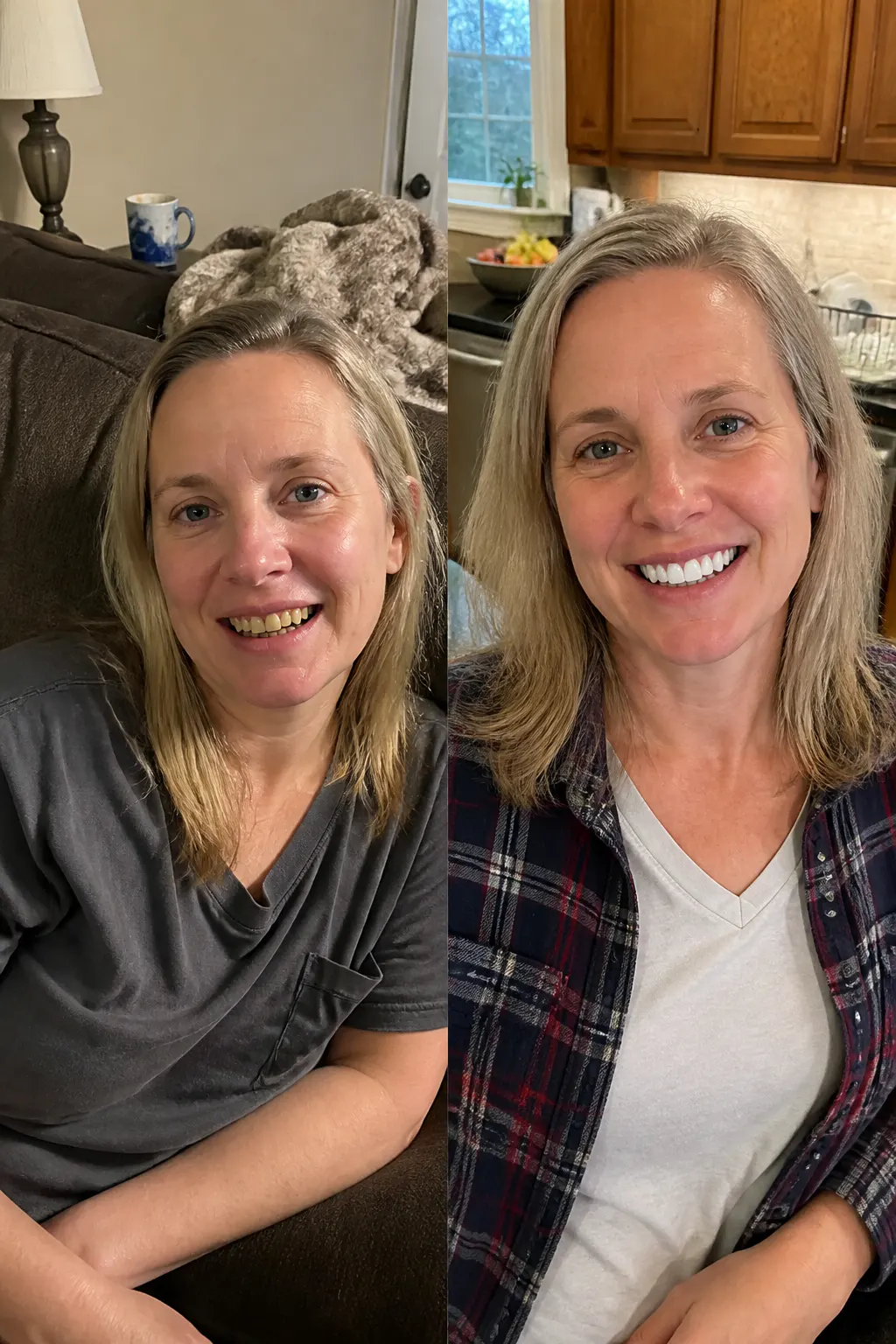Before and after - Marcus D.