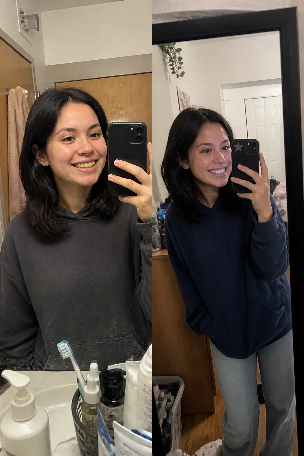 Before and after - Priya N.